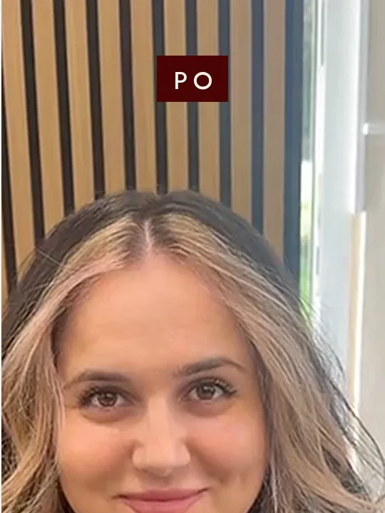 Po contouringu: světlé prameny kolem obličeje na černé barvě — Newtone Brno